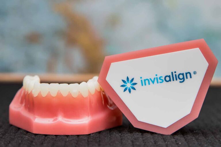 Picking the Best Option: Invisalign vs. Implants in Las Vegas