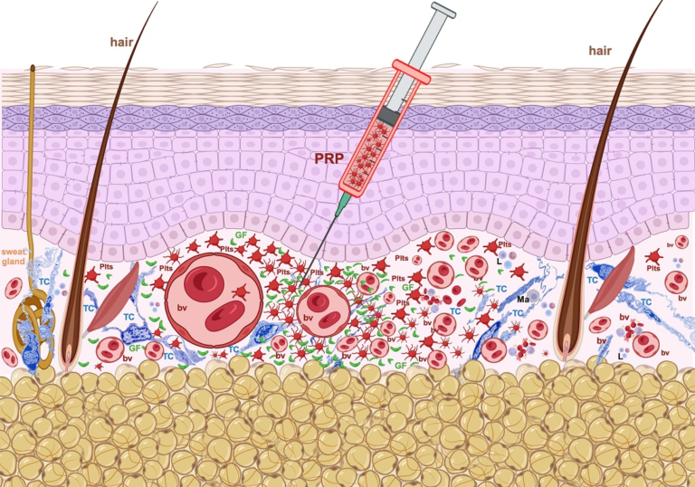 Understanding the Efficacy and Application of PRP Therapy in Dermatology
