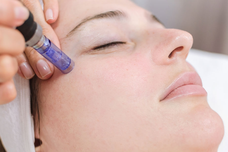 Micro-needling is a powerful game changer for the skin of your dreams