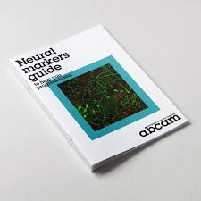 Alzheimer’s Disease: A Research Guide for Understanding Alzheimer’s Progression