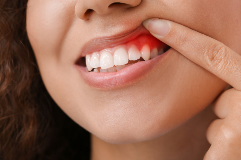 3 Signs It’s Time To Schedule A Dental Appointment